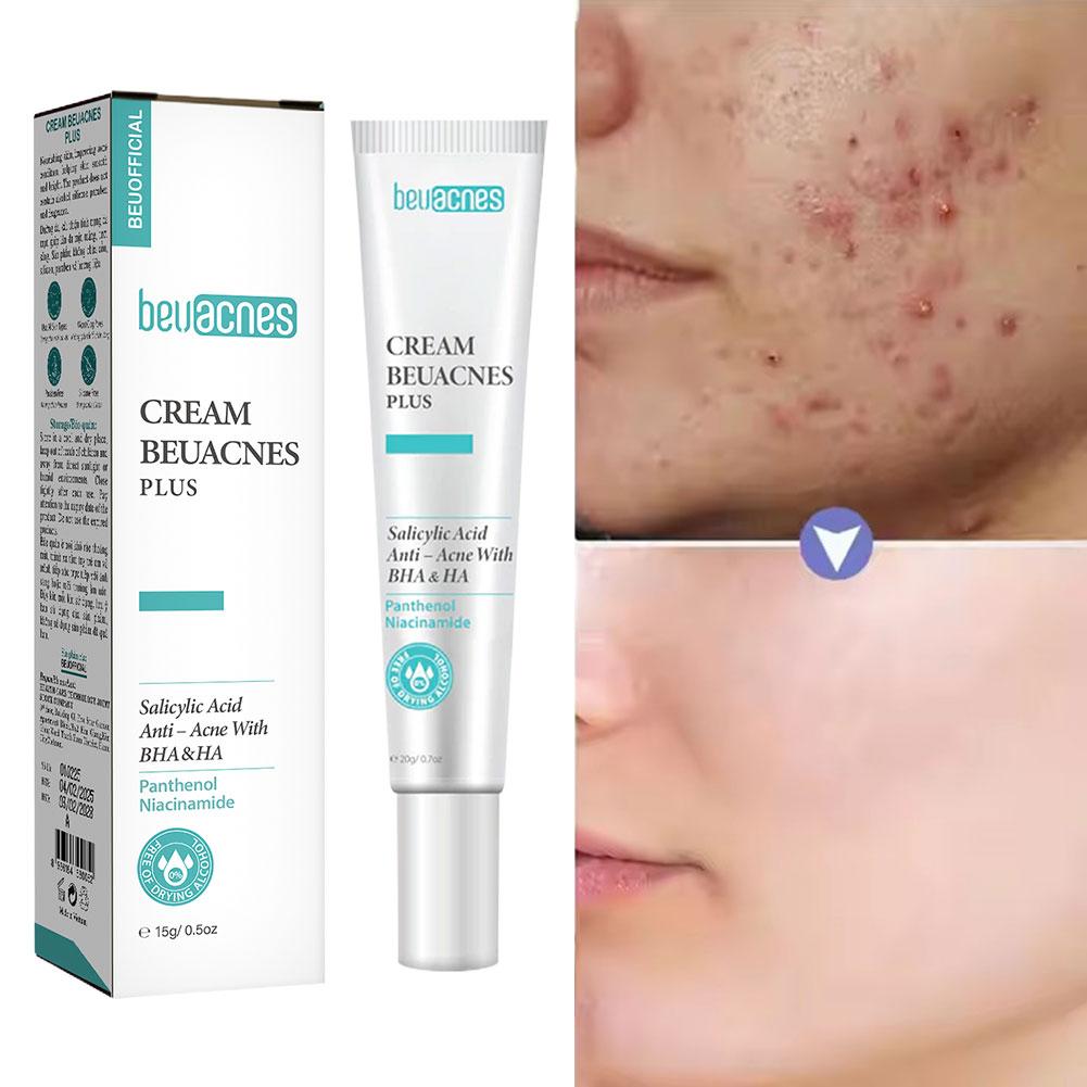 Skincare Niacinamide - New 20g Niacinamide Acne Gel Anti-acne