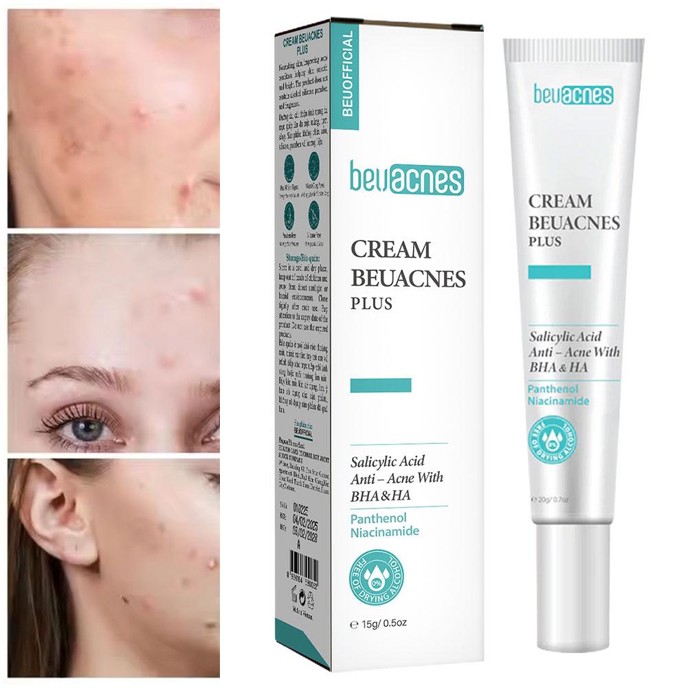New 20g Niacinamide Acne Gel A - Skincare Niacinamide review and price