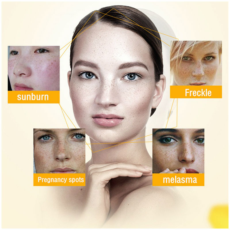Dimollaure Whitening Freckle C - Skincare Retinol review and price