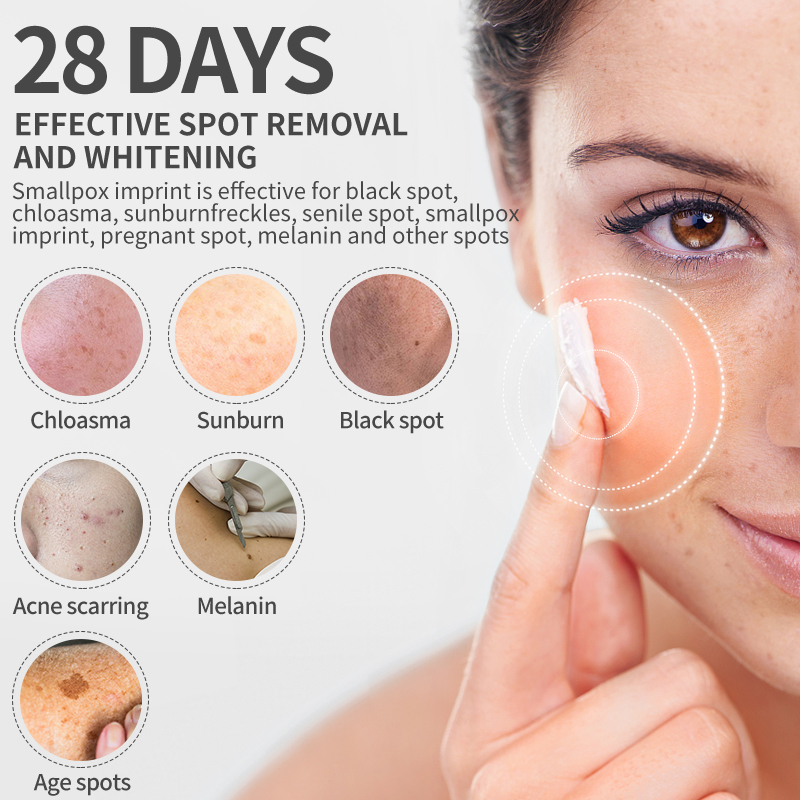 Dimollaure Whitening Freckle C - Skincare Retinol review and price
