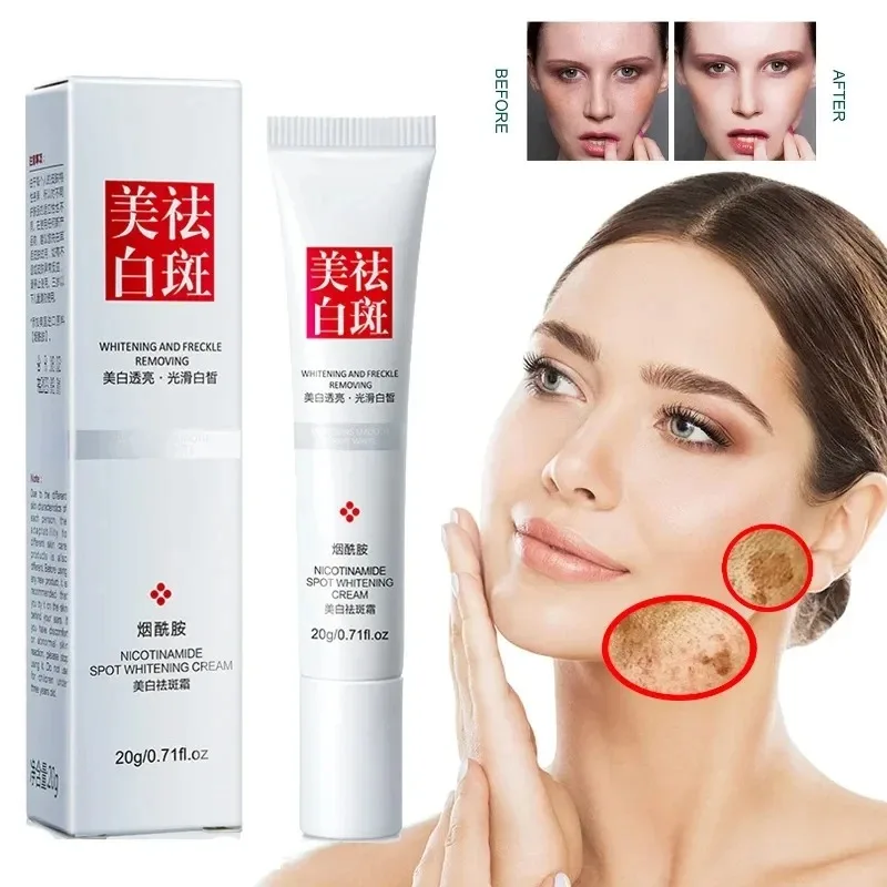 Fades Freckle Dark Spots Face  - Skincare Niacinamide review and price