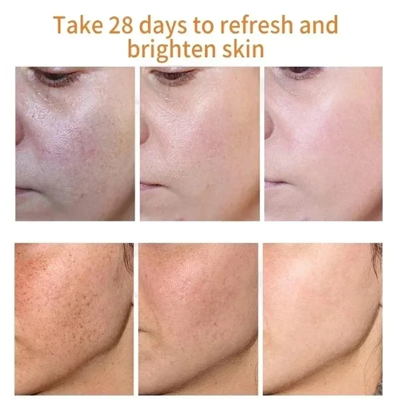 Fades Freckle Dark Spots Face  - Skincare Niacinamide review and price